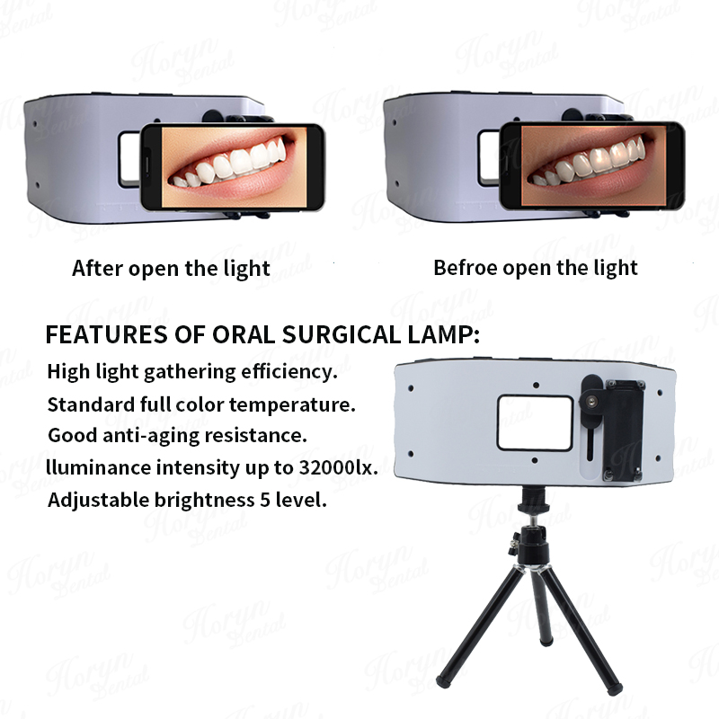 Luz de flash dental equipament - Photography Lighting Flash avaliação e preço